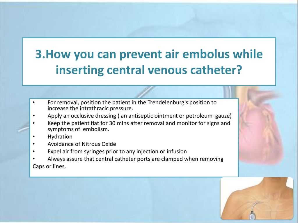 Trendelenburg Position For Air Embolism